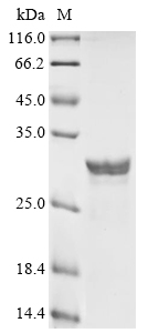 Human HPCA Protein