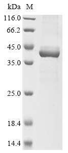 Human EPHX3 Protein