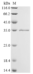Influenza A virus Non-structural protein 1 Protein