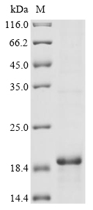 Human GPRC5D Protein