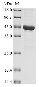 Human HPDL Protein
