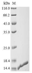 Human PYCARD Protein