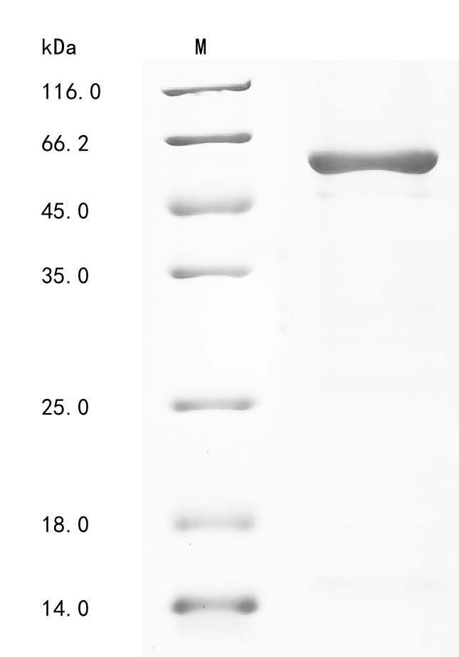 Human PKM Protein