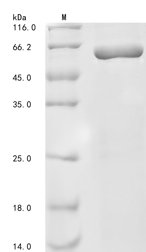 Human NEFL Protein