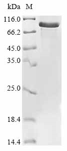 Human WEE1 Protein