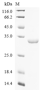 Human PDCD6IP Protein
