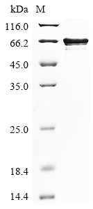 Human LARP6 Protein
