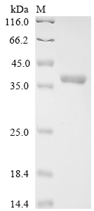 Human IFI35 Protein