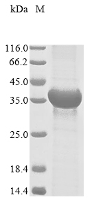 Human DCK Protein