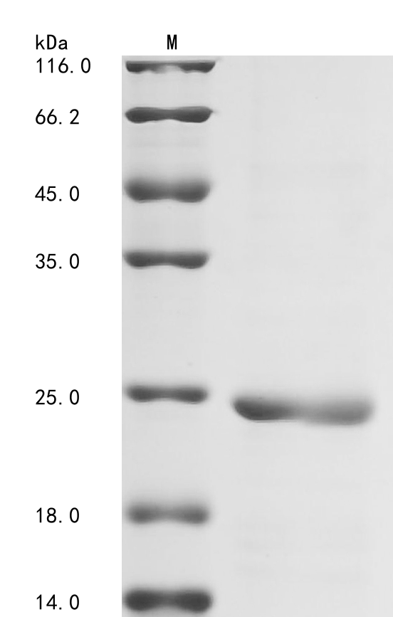 Medicago truncatula LysM domain Protein