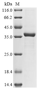 Bovine PPT1 Protein