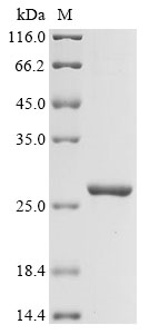 Human KDM6A Protein
