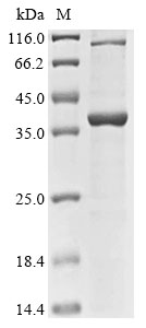 Human RPS4Y1 Protein