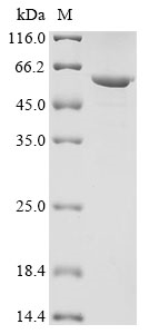 Human KRT13 Protein