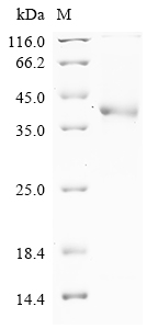 Human PRSS1 Protein
