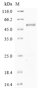 Human PAH Protein