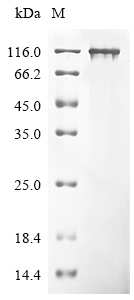 Human PPARGC1A Protein