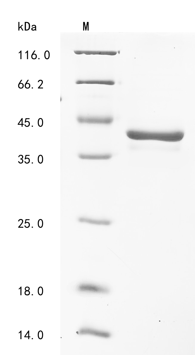 Human RAD51 Protein