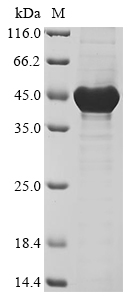 Human NCOR2 Protein
