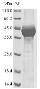 Human TSC1 Protein