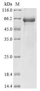 Human GPT2 Protein
