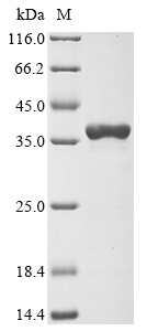 Human cytomegalovirus Capsid scaffolding Protein