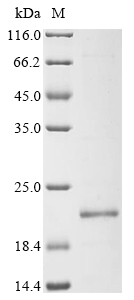 Human CARD17 Protein