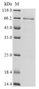 Human IL26 Protein (Biotin)