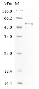 Tobacco mosaic virus Replicase large subunit Protein