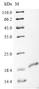 Human ZDHHC5 Protein