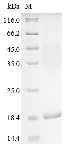 Human Sarcolipin Protein