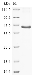 Human KDM6B Protein