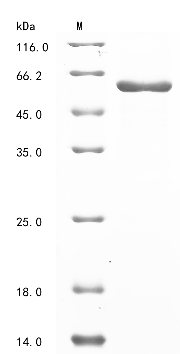 Human TUBB2A Protein