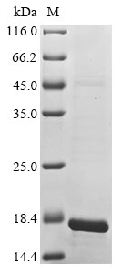 Human CCSER2 Protein