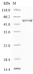 Human CECR1 Protein