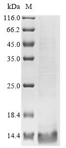 Avian infectious bronchitis virus Non-structural protein 5b Protein