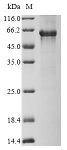 Human TDG Protein