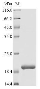 Human AP3B2 Protein
