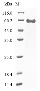 Human SPTA1 Protein