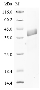 Human QSOX1 Protein
