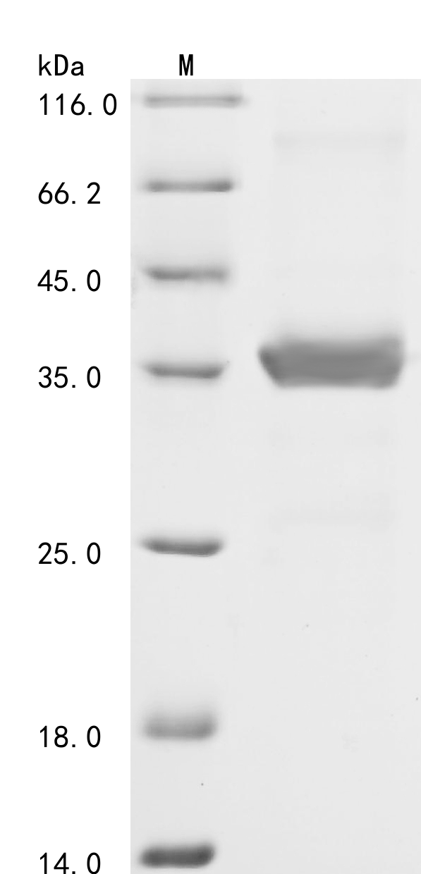 Human FFAR3 Protein
