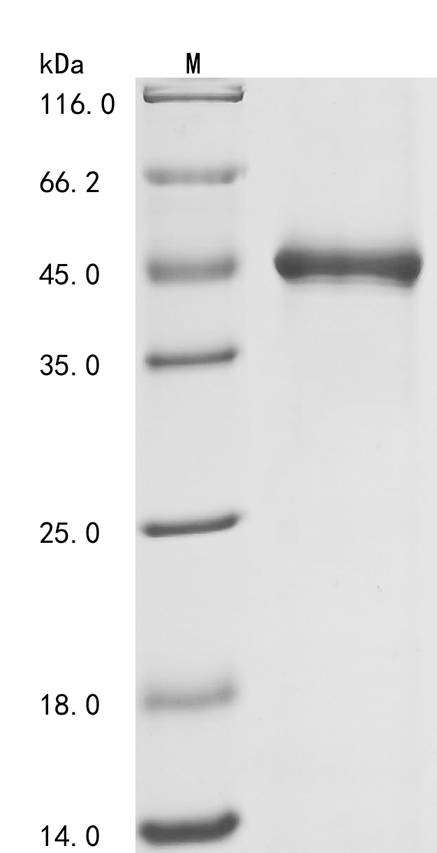 Human FCGR3B Protein