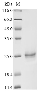 Human EPS15 Protein