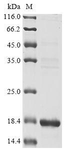 Plasmodium falciparum Circumsporozoite Protein
