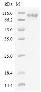 Human EPB41L5 Protein
