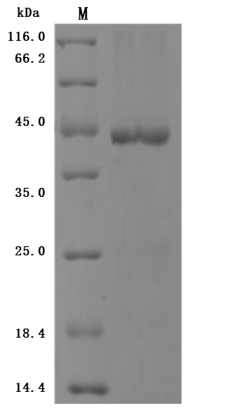 Human BRD4 Protein