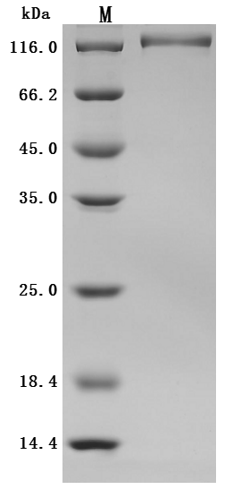 ENPP3 Protein