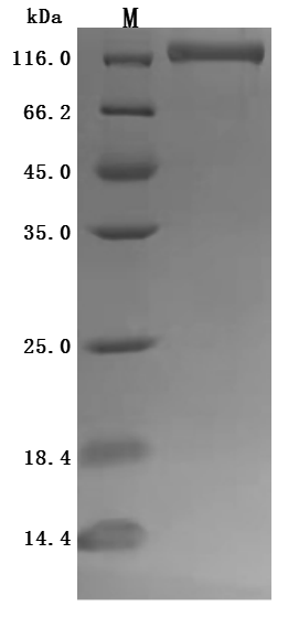 Human ENPP3 Protein