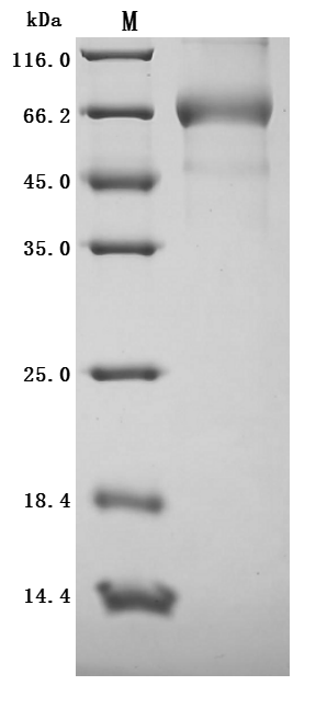 Human ALPI Protein
