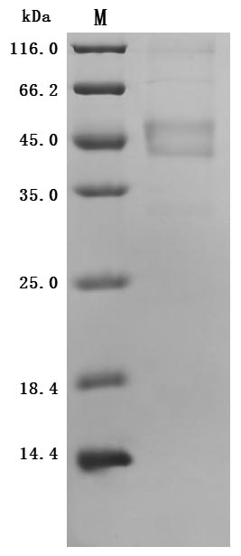 Human MAGEA4 Protein
